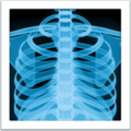 X Ray Emoji Apple